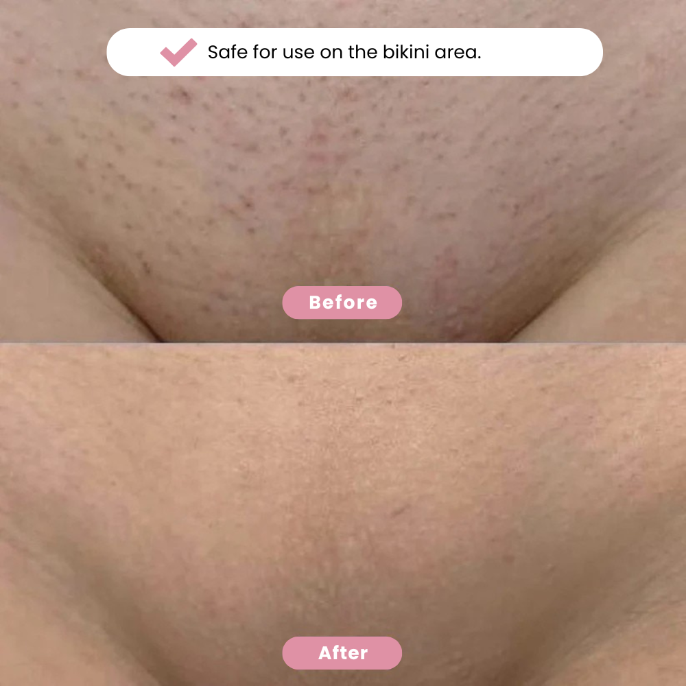 Yaurri™ Bikini Trimmer