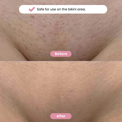 Yaurri™ Bikini Trimmer