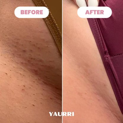 Yaurri™ Bikini Trimmer