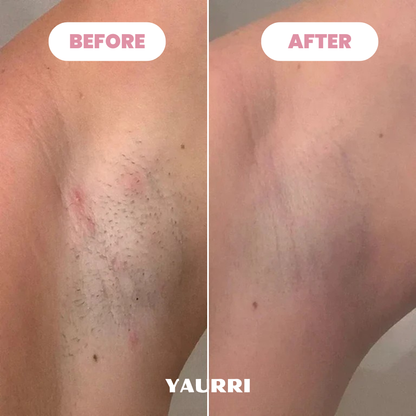 Yaurri™ Bikini Trimmer