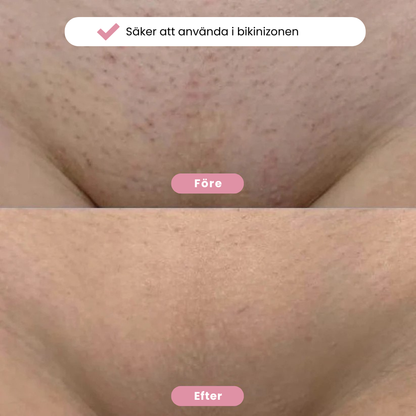 Yaurri™ Bikinitrimmer