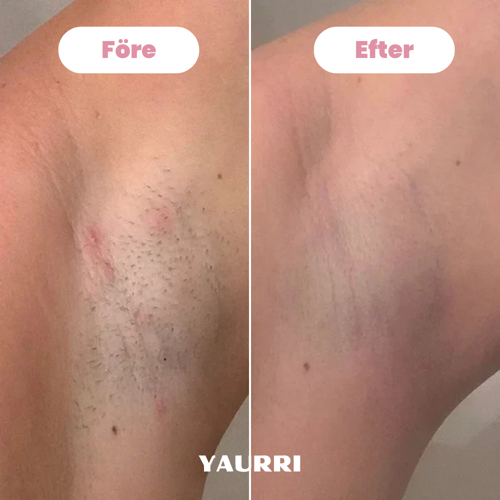 Yaurri™ Bikinitrimmer